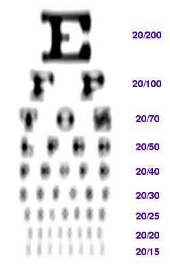 Features information about normal vision, astigmatism (when the eye's surface is curved, causing blurred vision), presbyopia (when it's difficult to focus on . . Vision simulator astigmatism